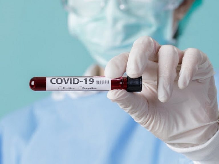 covid-19-nivel-national-768x577_1_0d519.jpg