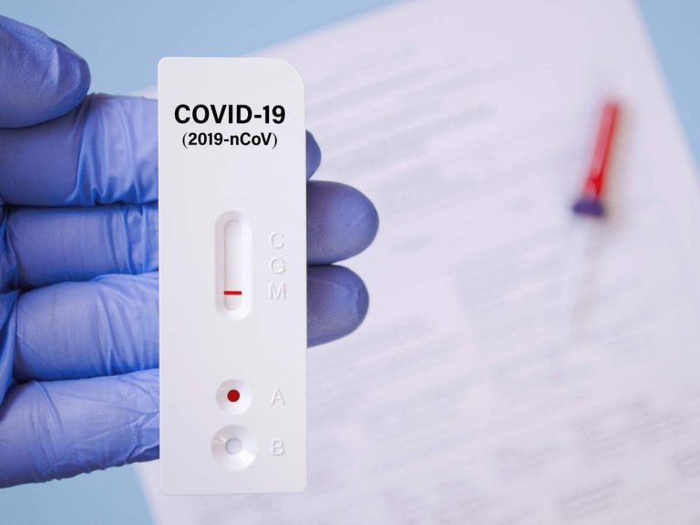 while-rapid-antigen-tests-detect-viral-protein-the-rt-pcr-tests-detect-viral-rna-or-its-genetic-material--768x576_0b9dc.jpg